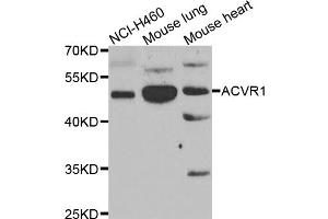 Western blot analysis of extracts of various cell lines, using ACVR1 antibody (ABIN5975601) at 1/1000 dilution. (ACVR1 抗体)