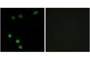 Immunofluorescence analysis of MCF7 cells, using TP53INP2 Antibody. (TP53INP2 抗体  (AA 1-50))