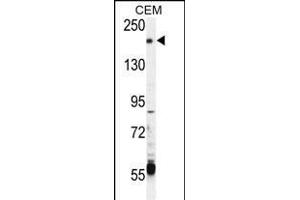 CHAK2 Antibody  (ABIN392616 and ABIN2842133) western blot analysis in CEM cell line lysates (35 μg/lane). (TRPM6 抗体  (AA 317-348))