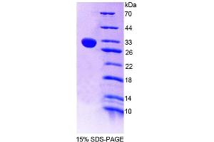SDS-PAGE analysis of Mouse CHIT1 Protein.