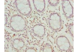 Immunohistochemistry of paraffin-embedded human colon tissue using ABIN7147805 at dilution of 1:100 (CLYBL 抗体  (AA 23-340))