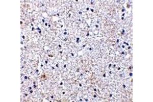 Immunohistochemistry (IHC) image for anti-SCO1 Cytochrome C Oxidase Assembly Protein (SCO1) (Middle Region) antibody (ABIN1031080) (SCO1 抗体  (Middle Region))