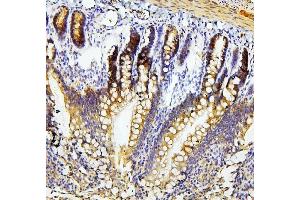 IHC analysis of RET using anti-RET antibody (ABIN6719502). (Ret Proto-Oncogene 抗体  (AA 29-304))