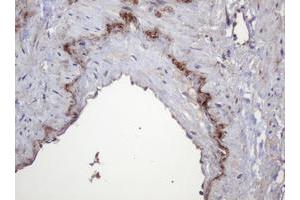Image no. 1 for anti-Parvin, beta (PARVB) antibody (ABIN1496912) (Parvin, beta 抗体)