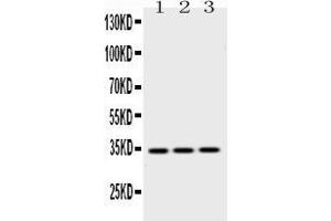 Western blot analysis of Emerin expression in rat skeletal muscle extract ( Lane 1), mouse cardiac muscle extract ( Lane 2) and HELA whole cell lysates ( Lane 3). (Emerin 抗体  (N-Term))