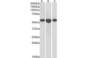 ABIN4902615 (1µg/ml) staining of Human Breast (A), Placenta (B) and Spleen (C) lysates (35µg protein in RIPA buffer). (SLC29A1 抗体)