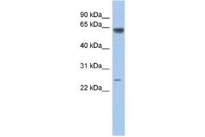 WB Suggested Anti-TAF5L Antibody Titration:  0. (TAF5L 抗体  (Middle Region))