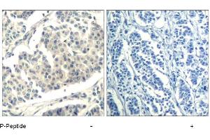 Image no. 1 for anti-Abelson Murine Leukemia Viral Oncogene Homolog 1/2 (ABL1/ABL2) (pTyr393), (pTyr439) antibody (ABIN319285) (ABL1/2 抗体  (pTyr393, pTyr439))