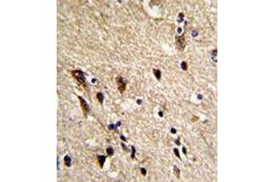 Immunohistochemical staining of formalin-fixed and paraffin-embedded human brain reacted with TUBB1 monoclonal antibody  at 1:10-1:50 dilution.