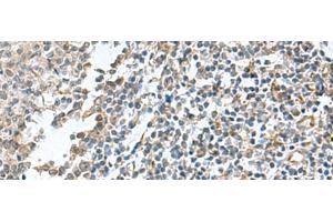 Immunohistochemistry of paraffin-embedded Human tonsil tissue using PAPSS2 Polyclonal Antibody at dilution of 1:95(x200) (PAPSS2 抗体)