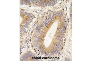 Immunohistochemistry (Paraffin-embedded Sections) (IHC (p)) image for anti-Aldo-Keto Reductase Family 1, Member B1 (Aldose Reductase) (AKR1B1) (AA 102-135) antibody (ABIN389206)