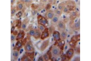 Used in DAB staining on fromalin fixed paraffin-embedded Liver tissue (COL18 抗体  (AA 1591-1774))