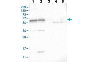 Western blot analysis of Lane 1: RT-4, Lane 2: U-251 MG, Lane 3: Human Plasma, Lane 4: Liver, Lane 5: Tonsil with C17orf70 polyclonal antibody  at 1:250-1:500 dilution. (C17orf70 抗体)