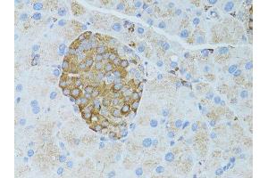 Immunohistochemistry (Paraffin-embedded Sections) (IHC (p)) image for anti-Occludin (OCLN) (AA 263-522) antibody (ABIN6144996)