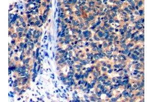 Immunohistochemistry (IHC) image for anti-Programmed Cell Death 1 (PDCD1) (AA 41-132) antibody (ABIN7440431)