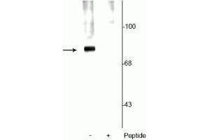 Western blot of rat cortical lysate showing specific labeling of the ~78 kDa synapsin protein phosphorylated at Ser62,67 in the first lane (-). (SYN1 抗体  (pSer62, pSer67))