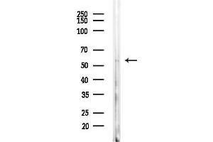anti-Coiled-Coil Domain Containing 102A (CCDC102A) (Internal Region) antibody