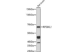 Western blot analysis of extracts of Rat brain cells, using RPS6KL1 antibody (ABIN6130681, ABIN6147242, ABIN6147243 and ABIN6223376) at 1:1000 dilution. (RPS6KL1 抗体  (AA 1-130))