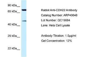 Western Blotting (WB) image for anti-Cadherin-Like 22 (CDH22) (N-Term) antibody (ABIN2783833) (CDH22 抗体  (N-Term))