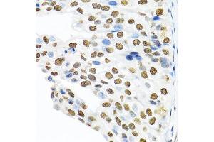 Immunohistochemistry (Paraffin-embedded Sections) (IHC (p)) image for anti-Polypyrimidine Tract Binding Protein 1 (PTBP1) (AA 1-100) antibody (ABIN6146371)