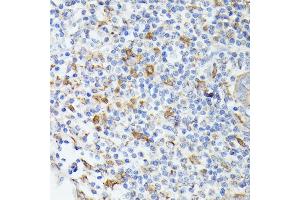 Immunohistochemistry of paraffin-embedded human appendix using TI antibody (ABIN6133213, ABIN6149144, ABIN6149145 and ABIN6221696) at dilution of 1:100 (40x lens). (TIAL1 抗体  (AA 266-375))