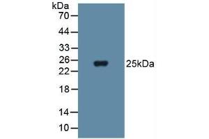 Detection of SOD3 in Human Blood Cells using Polyclonal Antibody to Superoxide Dismutase 3, Extracellular (SOD3) (SOD3 抗体  (AA 19-240))