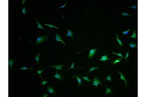Immunofluorescence staining of U251 cells with ABIN7148054-IF at 1:100, counter-stained with DAPI. (CCHCR1 抗体  (AA 281-500))