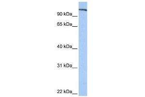 FES antibody used at 1 ug/ml to detect target protein. (FES 抗体  (N-Term))