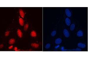 IF analysis of RENT1/hUPF1 using anti-RENT1/hUPF1 antibody (ABIN7602979). (RENT1/UPF1 抗体  (Middle Region))