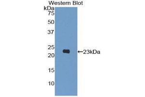 Western Blotting (WB) image for anti-Phosphoinositide-3-Kinase, Catalytic, beta Polypeptide (PIK3CB) (AA 321-507) antibody (ABIN1860219)