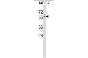 Western blot analysis in MCF-7 cell line lysates (35ug/lane). (ZNF383 抗体  (N-Term))