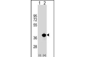 Western blot analysis of T1 (arrow) using rabbit polyclonal T1 Antibody (Center) (ABIN1538005 and ABIN2848794). (PPT1 抗体  (AA 189-217))