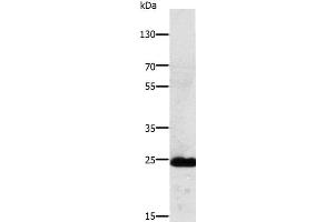 Western Blot analysis of Mouse lung tissue using RALB Polyclonal Antibody at dilution of 1:250 (RALB 抗体)
