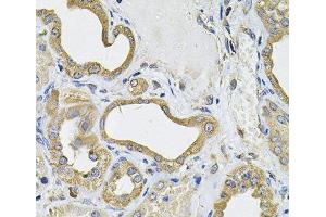Immunohistochemistry of paraffin-embedded Human kidney using ICOSL Polyclonal Antibody at dilution of 1:100 (40x lens). (ICOSLG 抗体)