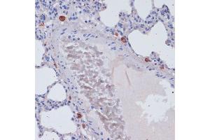 Immunohistochemistry of paraffin-embedded rat lung using Perforin antibody (ABIN3020641, ABIN3020642, ABIN3020643 and ABIN6213612) at dilution of 1:100 (40x lens). (Perforin 1 抗体  (AA 280-555))