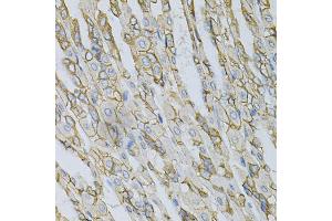 Immunohistochemistry of paraffin-embedded mouse stomach using AP2B1 Antibody (ABIN5971039) at dilution of 1/100 (40x lens). (AP2B1 抗体)