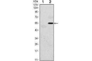 Western Blot showing EIF2AK3 antibody used against HEK293 (1) and EIF2AK3 (AA: 929-1116)-hIgGFc transfected HEK293 (2) cell lysate. (PERK 抗体)