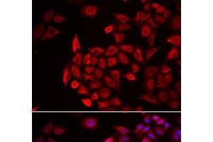 Immunofluorescence analysis of HeLa cells using COCH Polyclonal Antibody (COCH 抗体)