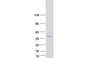 IBA57 Protein (Myc-DYKDDDDK Tag)