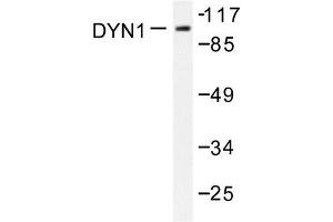 Image no. 1 for anti-Dynamin 1 (DNM1) antibody (ABIN271884) (Dynamin 1 抗体)