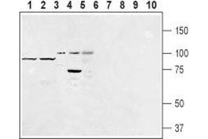 Western blot analysis of rat fat (lanes 1 and 6), mouse fat (lanes 2 and 7), human Burkitt's lymphoma (Raji) (lanes 3 and 8), rat basophilic leukemia (RBL) (lanes 4 and 9) and human promyelocytic leukemia  (lanes 5 and 10) lysates:1-5.