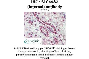 Image no. 1 for anti-Solute Carrier Family 44, Member 2 (SLC44A2) (Internal Region) antibody (ABIN1739381) (SLC44A2 抗体  (Internal Region))