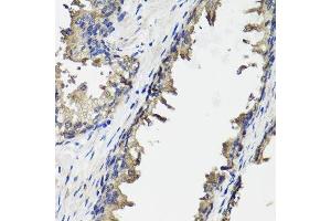 Immunohistochemistry of paraffin-embedded human prostate using OTC antibody. (OTC 抗体  (AA 215-354))