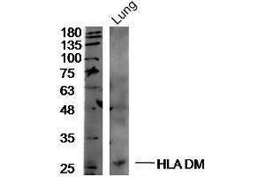 Mouse lung lysates probed with Rabbit Anti-HLA DM Polyclonal Antibody, Unconjugated  at 1:300 overnight at 4˚C. (HLA-DM 抗体  (AA 101-200))