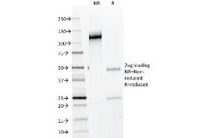 SDS-PAGE Analysis Purified NKX2. (Nkx2-2 抗体)