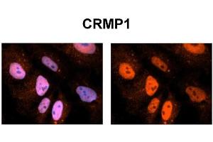 Sample Type:    NT2 cells   Red:  Antibody   Blue:  DAPI   Primary Dilution:  1ug/50ul antibody   Secondary Antibody:  Alexa goat anti-rabbit 594   Image Submitted by:    Yuzhi Chen, University of Arkansas for Medical Sciences  