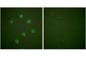 Immunofluorescence (IF) image for anti-Antigen Identified By Monoclonal Antibody Ki-67 (MKI67) (AA 3207-3256) antibody (ABIN2889217) (Ki-67 抗体  (AA 3207-3256))