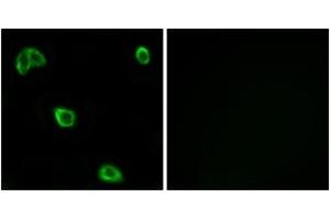Immunofluorescence analysis of LOVO cells, using OR10K1/10K2 Antibody. (OR10K1/K2 抗体  (AA 56-105))