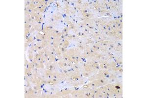 Immunohistochemistry of paraffin-embedded mouse heart using ARHGEF9 antibody (ABIN5975759) at dilution of 1/100 (40x lens). (Arhgef9 抗体)