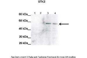 Lanes:   Lane1: 100ug uninduced RPE-1 lysate Lane2: 100ug uninduced RPE-1 lysate Lane3: 100ug STK3 induced RPE-1 lysate Lane4: 100ug STK3 induced RPE-1 lysate  Primary Antibody Dilution:   1:2000  Secondary Antibody:   Anti-rabbit HRP  Secondary Antibody Dilution:   1:5000  Gene Name:   STK3  Submitted by:   Anonymous (STK3 抗体  (C-Term))